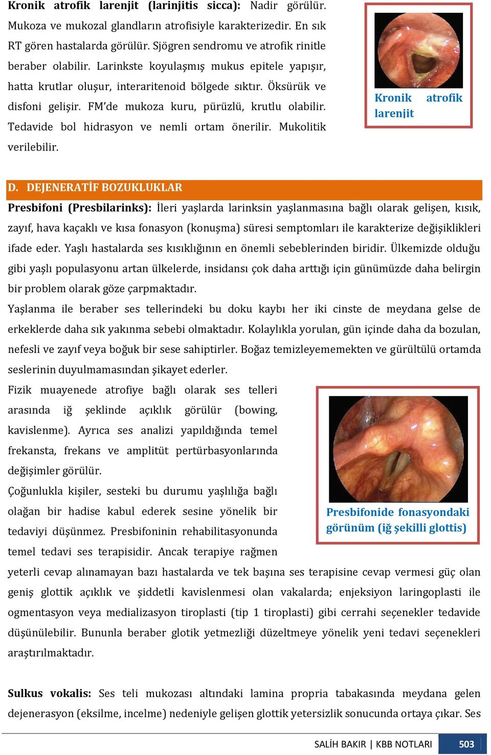 FM de mukoza kuru, pürüzlü, krutlu olabilir. Tedavide bol hidrasyon ve nemli ortam önerilir. Mukolitik Kronik larenjit atrofik verilebilir. D.