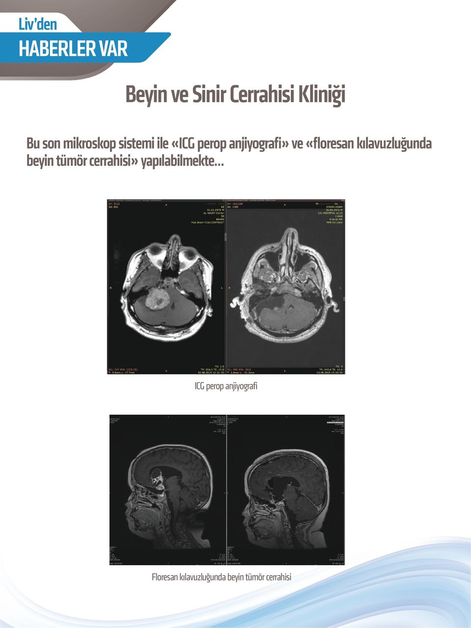 kılavuzluğunda beyin tümör cerrahisi» yapılabilmekte