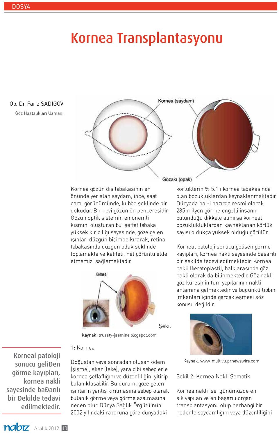 Gözün optik sistemin en önemli kısmını oluşturan bu şeffaf tabaka yüksek kırıcılığı sayesinde, göze gelen ışınları düzgün biçimde kırarak, retina tabakasında düzgün odak şeklinde toplamakta ve