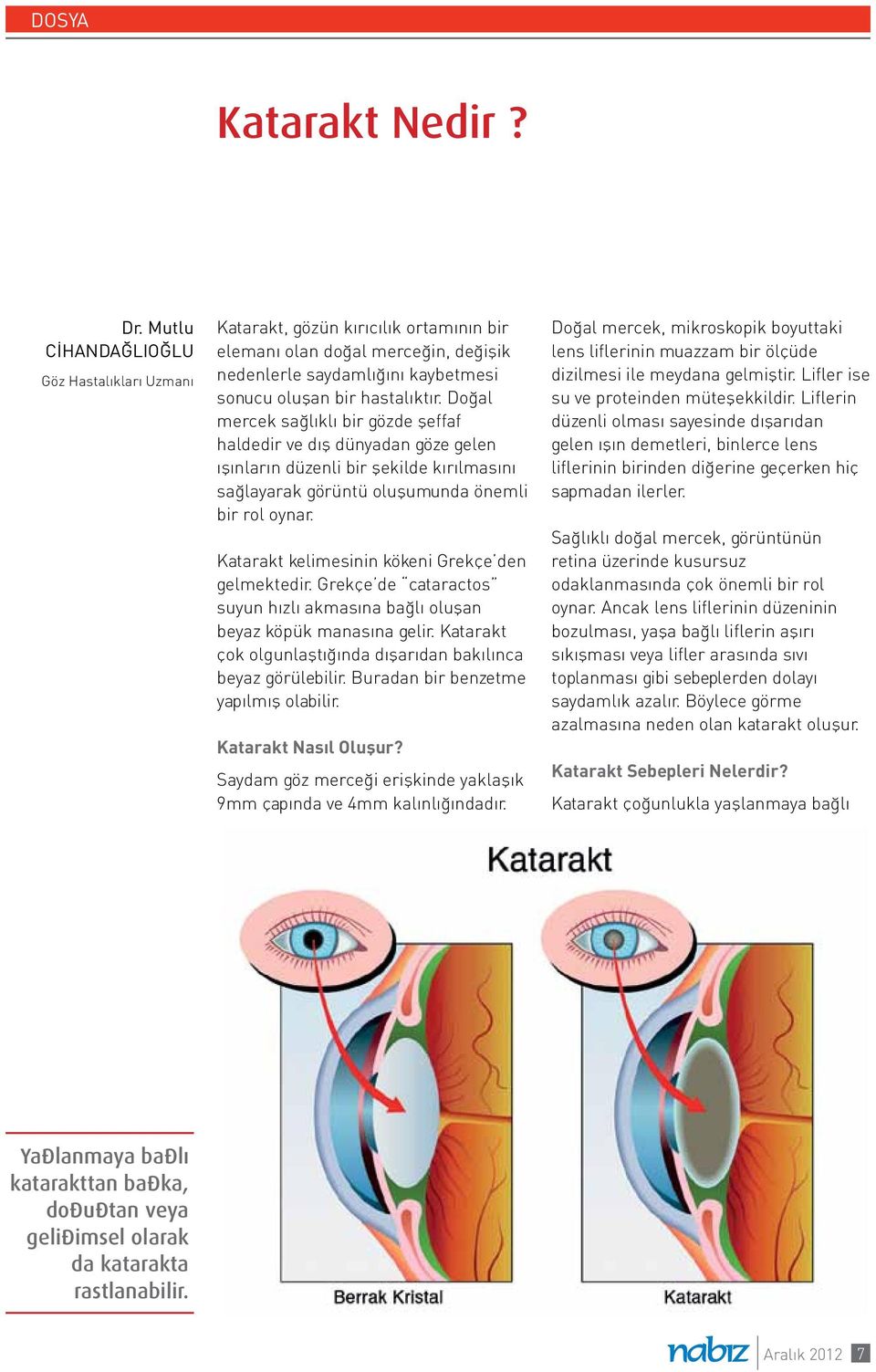 Doğal mercek sağlıklı bir gözde şeffaf haldedir ve dış dünyadan göze gelen ışınların düzenli bir şekilde kırılmasını sağlayarak görüntü oluşumunda önemli bir rol oynar.