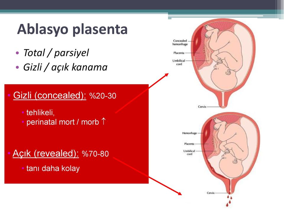 external hemorrhage tehlikeli, perinatal