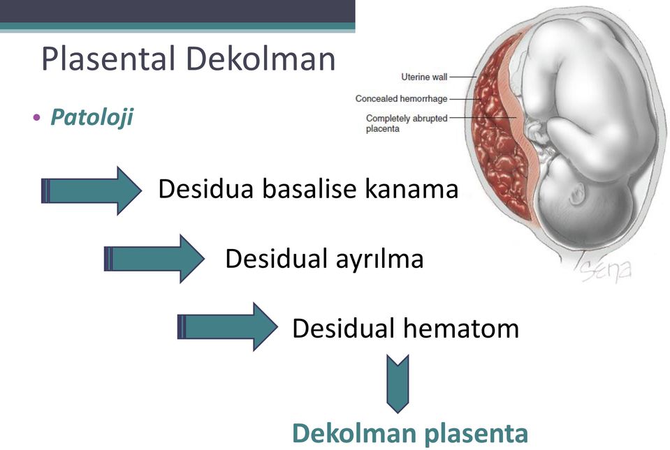 kanama Desidual ayrılma