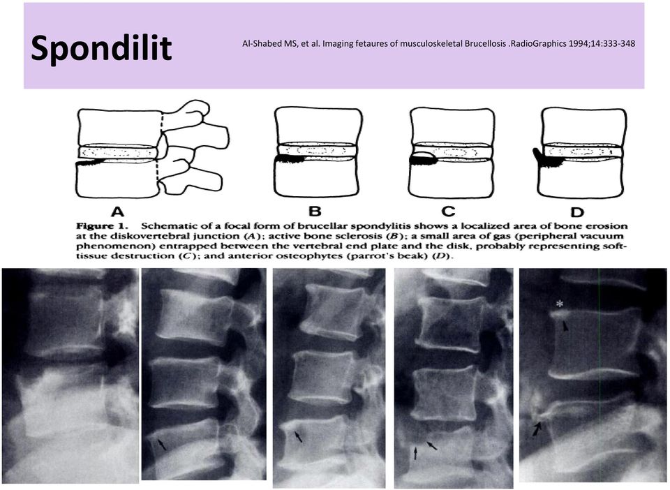 musculoskeletal