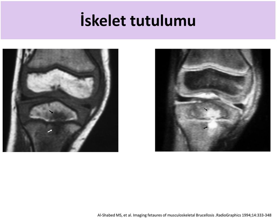 Imaging fetaures of