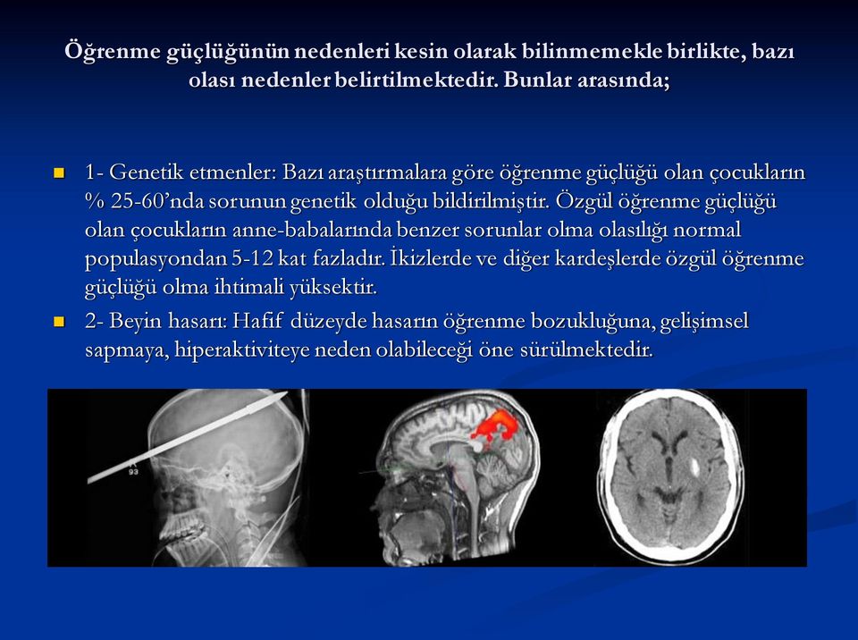 Özgül öğrenme güçlüğü olan çocukların anne-babalarında benzer sorunlar olma olasılığı normal populasyondan 5-12 kat fazladır.