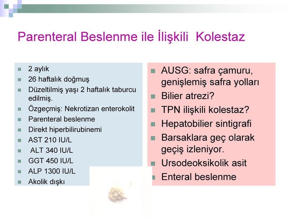 ÖzgeçmiĢ: Nekrotizan enterokolit Parenteral beslenme Direkt hiperbilirubinemi AST 210 IU/L ALT 340 IU/L GGT