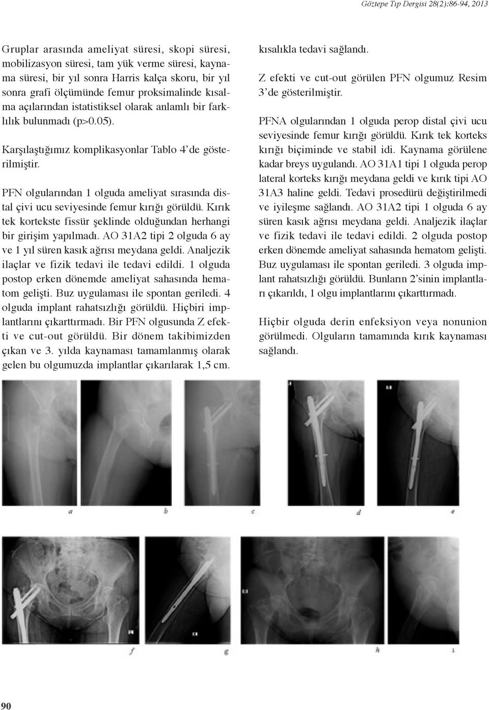 olgularından olguda ameliyat sırasında distal çivi ucu seviyesinde femur kırığı görüldü. Kırık tek kortekste fissür şeklinde olduğundan herhangi bir girişim yapılmadı.