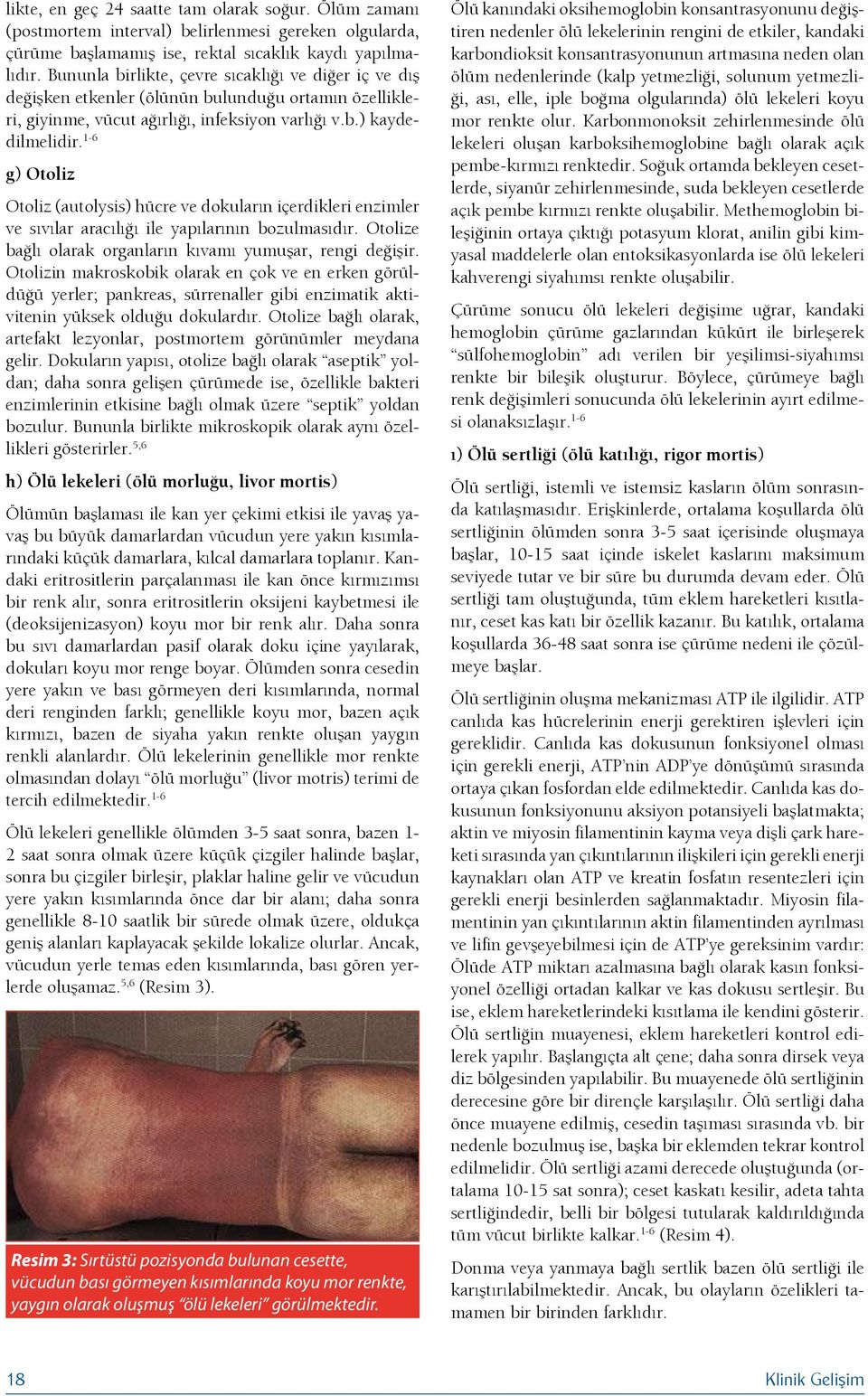 1-6 g) Otoliz Otoliz (autolysis) hücre ve dokuların içerdikleri enzimler ve sıvılar aracılığı ile yapılarının bozulmasıdır. Otolize bağlı olarak organların kıvamı yumuşar, rengi değişir.