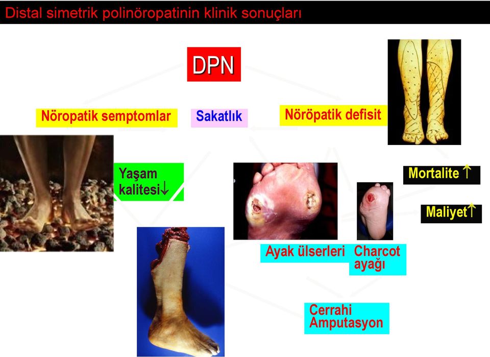 Nöröpatik defisit Yaşam kalitesi Mortalite