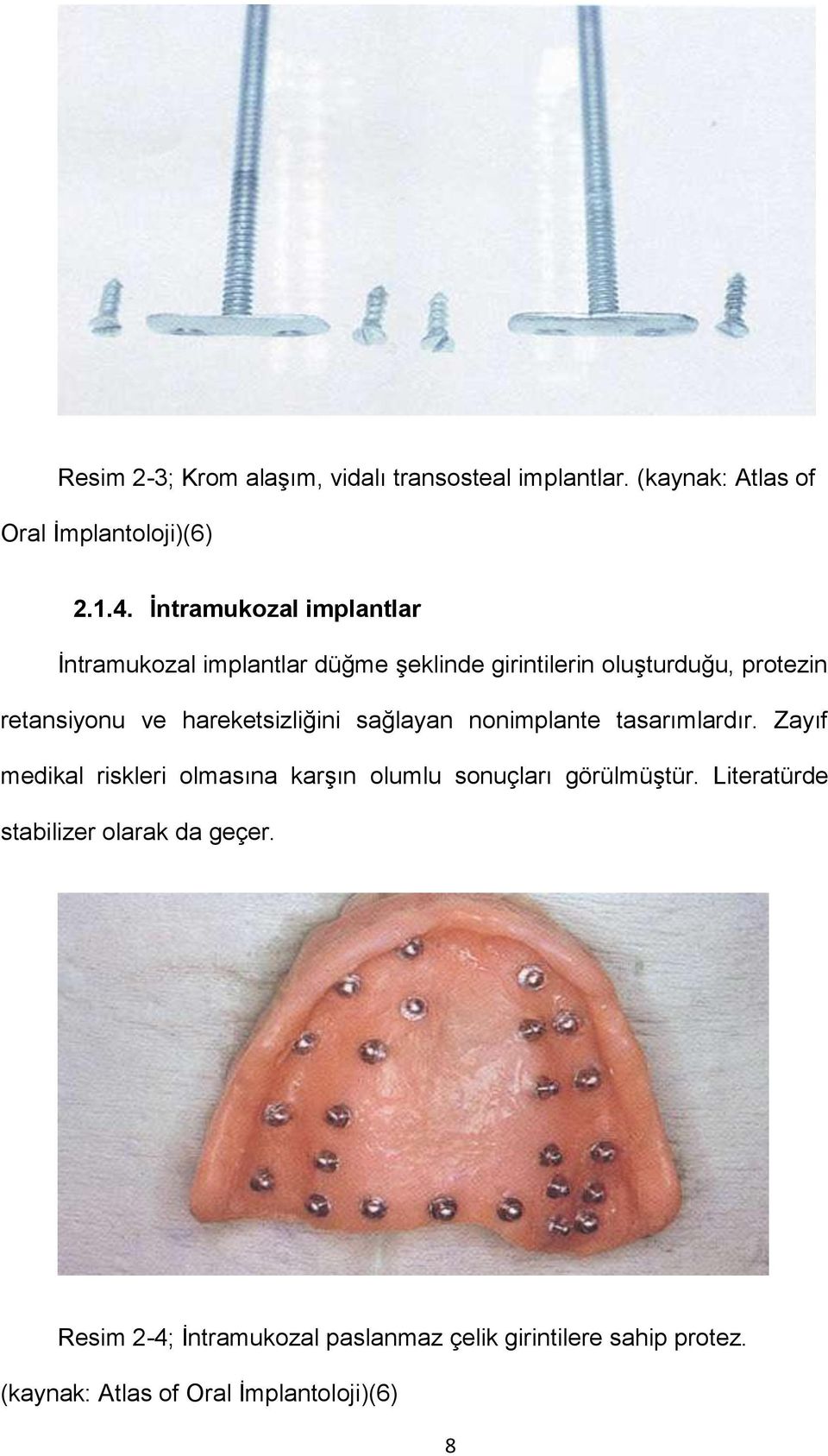 hareketsizliğini sağlayan nonimplante tasarımlardır. Zayıf medikal riskleri olmasına karşın olumlu sonuçları görülmüştür.