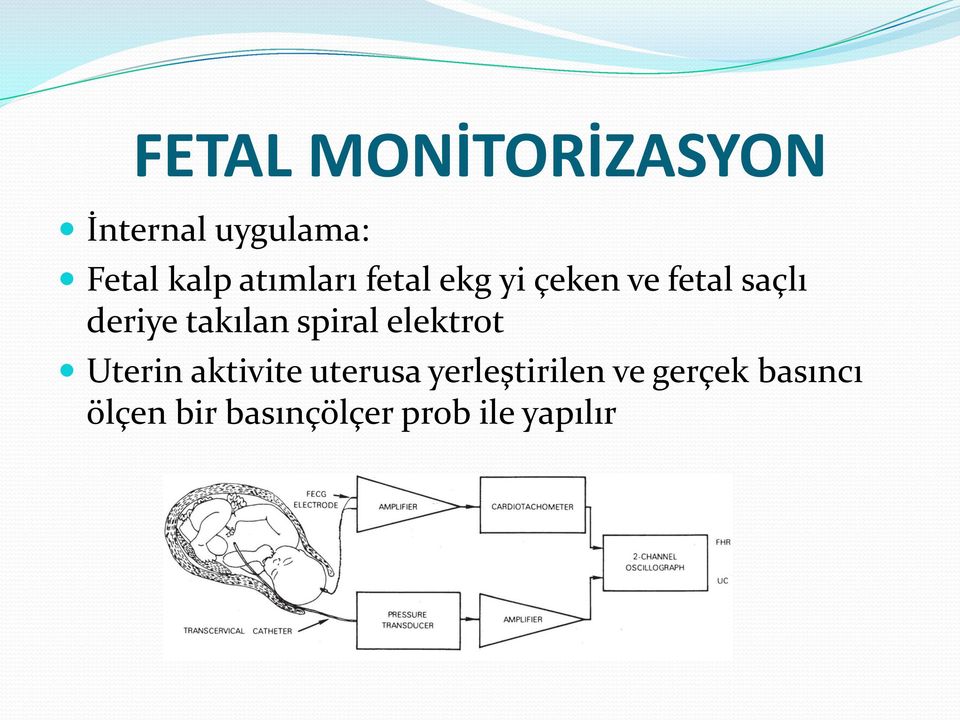 takılan spiral elektrot Uterin aktivite uterusa