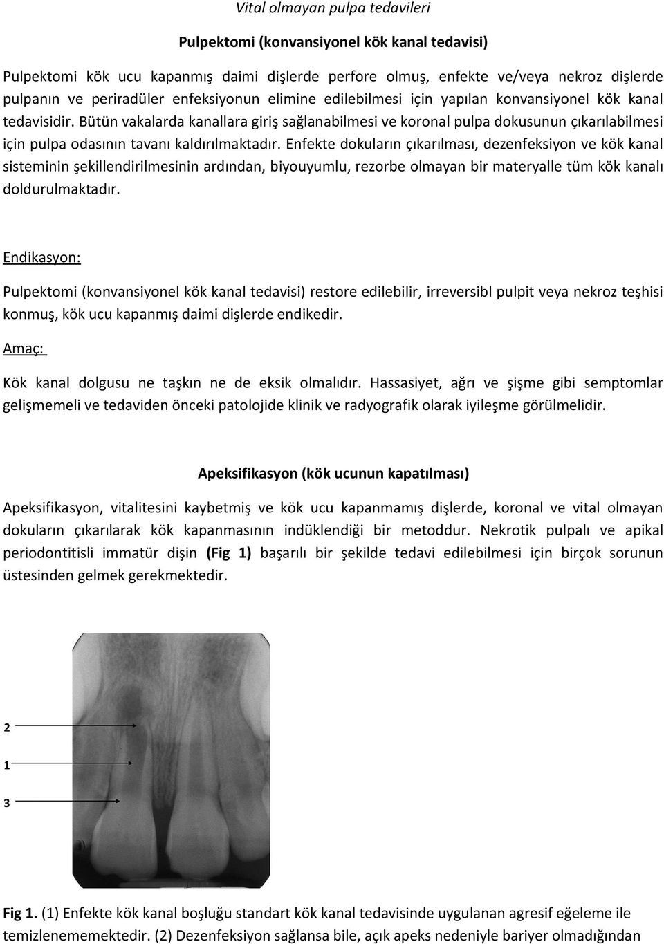 Bütün vakalarda kanallara giriş sağlanabilmesi ve koronal pulpa dokusunun çıkarılabilmesi için pulpa odasının tavanı kaldırılmaktadır.