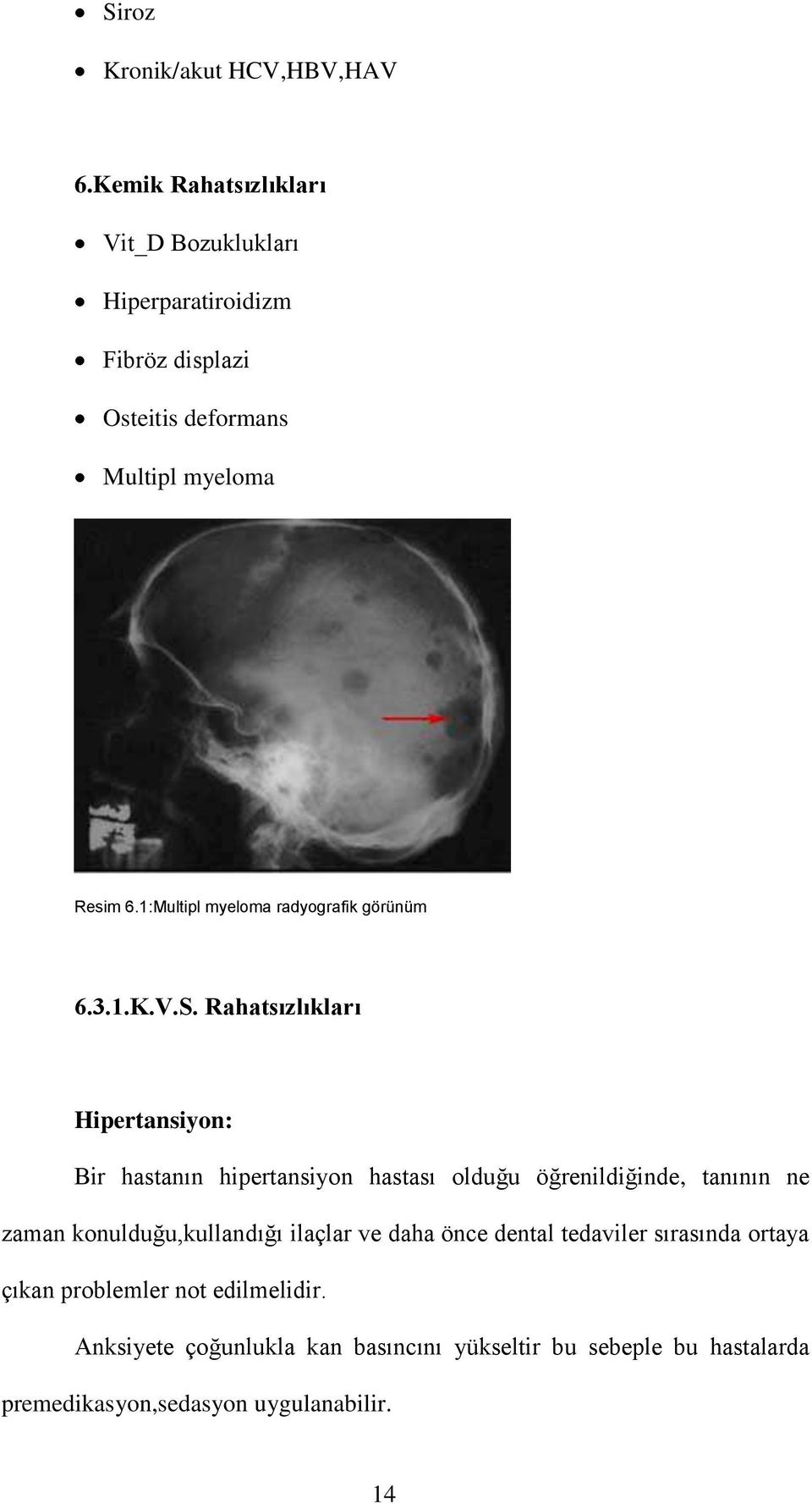 1:Multipl myeloma radyografik görünüm 6.3.1.K.V.S.