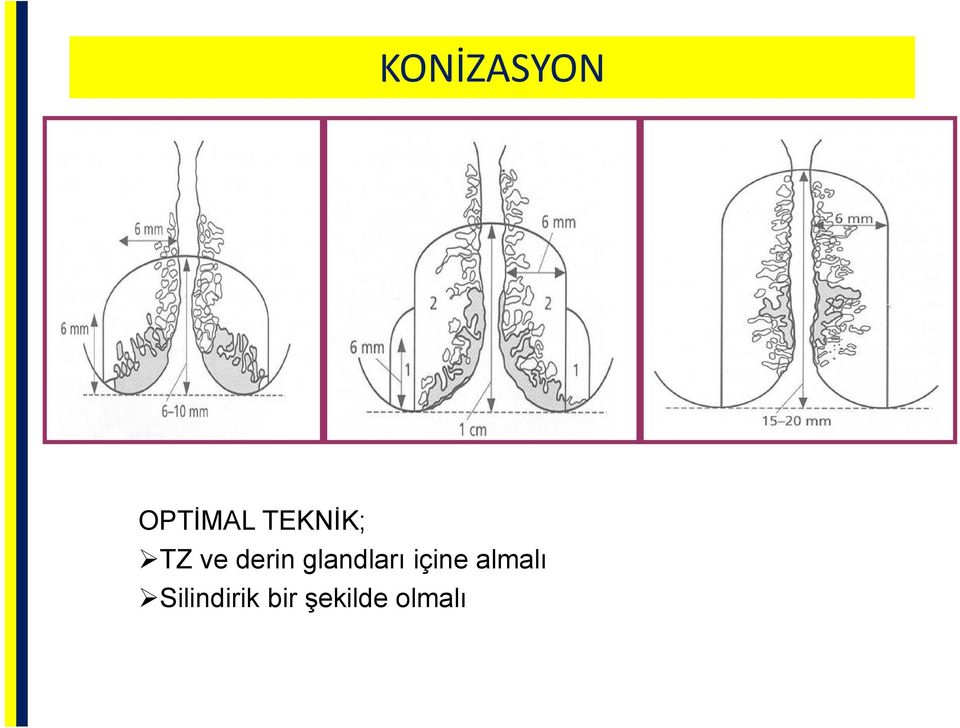 glandları içine almalı