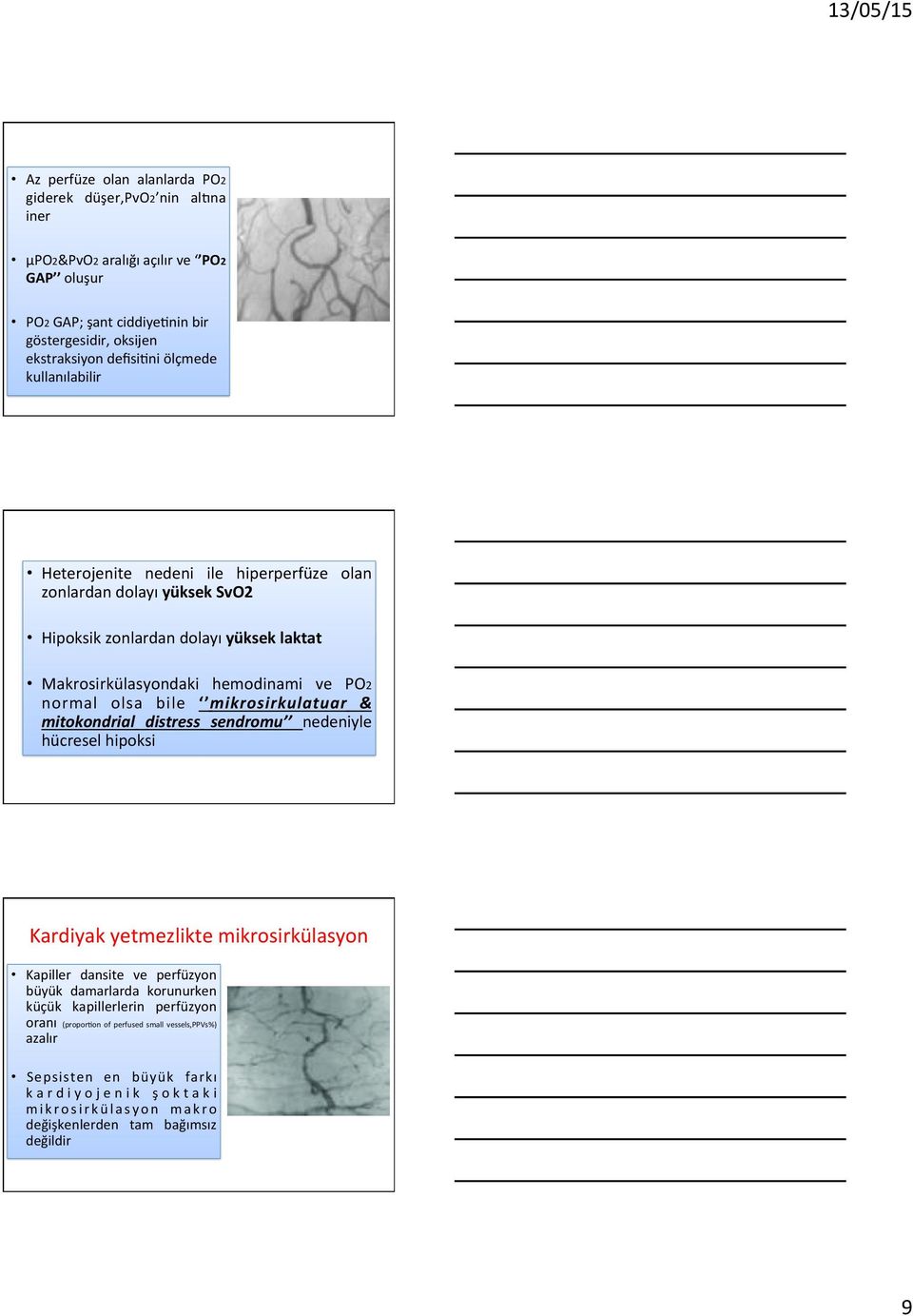 bile mikrosirkulatuar & mitokondrial distress sendromu nedeniyle hücresel hipoksi Kardiyak yetmezlikte mikrosirkülasyon Kapiller dansite ve perfüzyon büyük damarlarda korunurken küçük