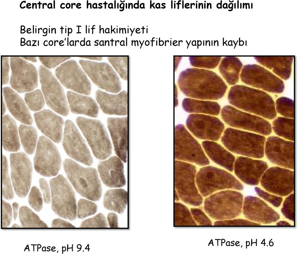 hakimiyeti Bazı core larda santral