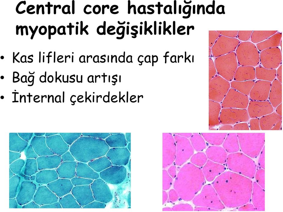 lifleri arasında çap farkı