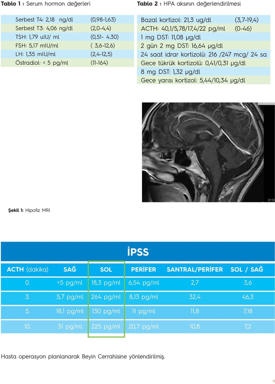 (0-46) 1 mg DST: 11,08 μg/dl 2 gün 2 mg DST: 16,64 μg/dl 24 saat idrar kortizolü: 216 /247 mcg/ 24 sa Gece tükrük kortizolü: 0,41/0,31 μg/dl 8 mg DST: 1,32 μg/dl Gece yarısı kortizol: 5,44/10,34