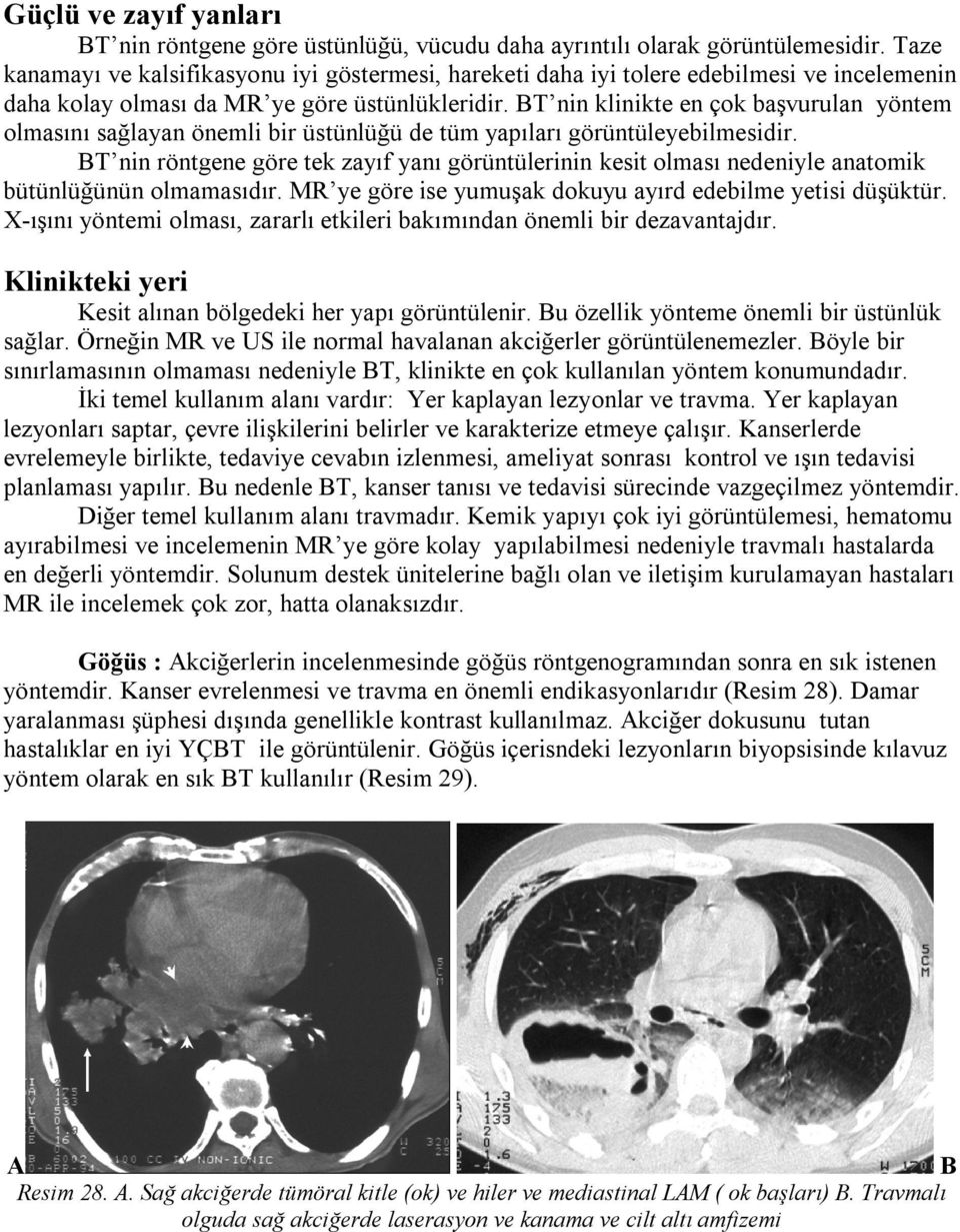 T nin klinikte en çok başvurulan yöntem olmasını sağlayan önemli bir üstünlüğü de tüm yapıları görüntüleyebilmesidir.