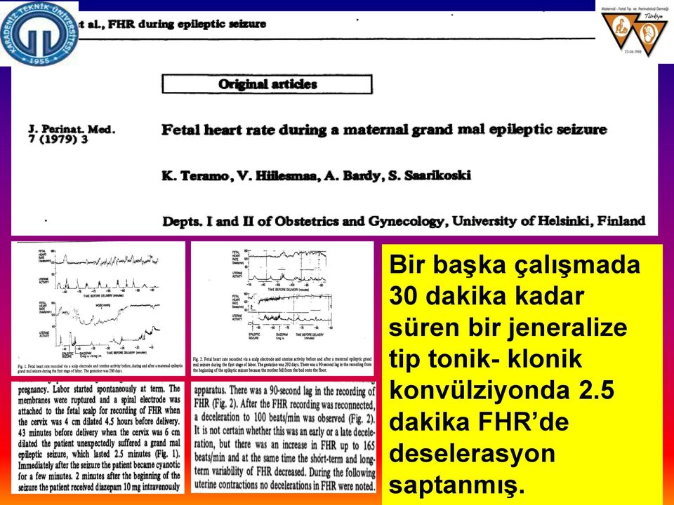 tonik- klonik konvülziyonda 2.