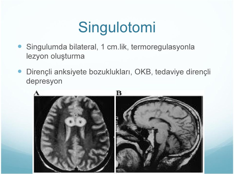 oluşturma Dirençli anksiyete