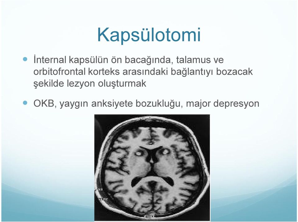 bağlantıyı bozacak şekilde lezyon oluşturmak