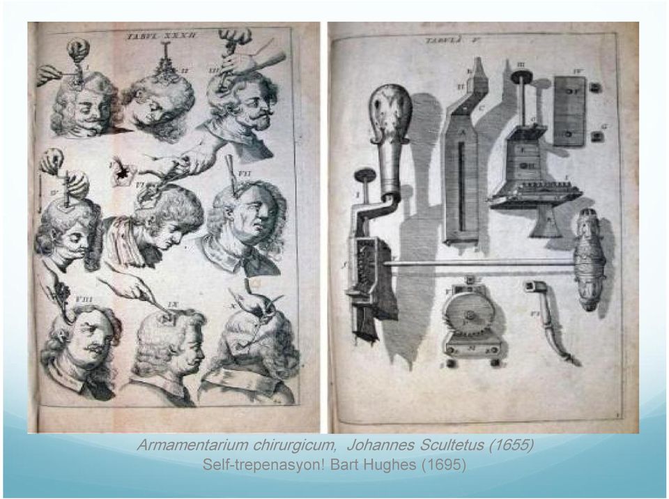 Scultetus (1655) Self