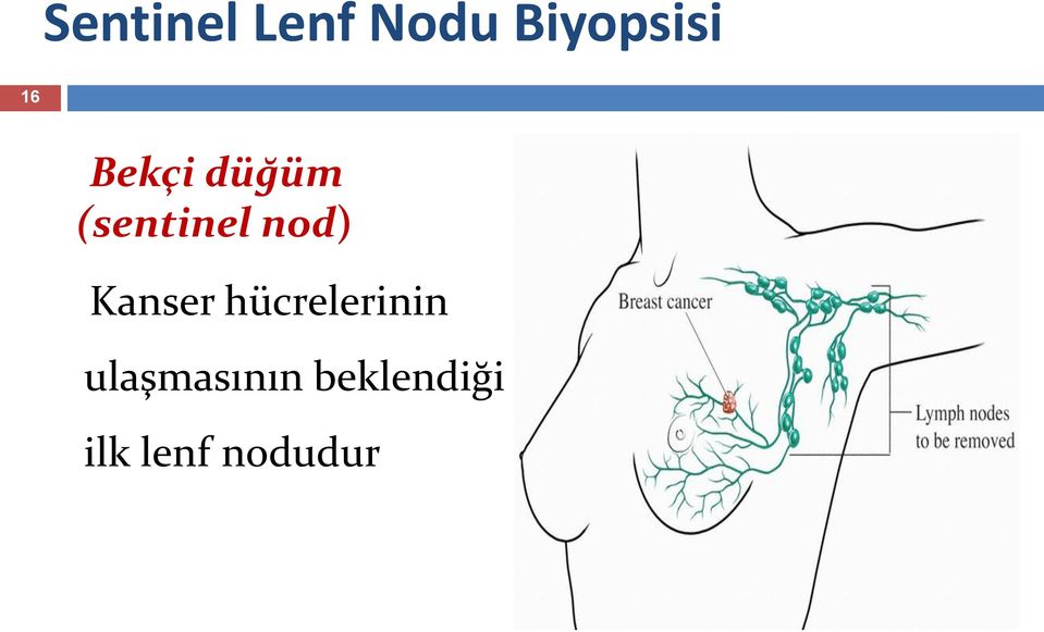 Kanser hücrelerinin