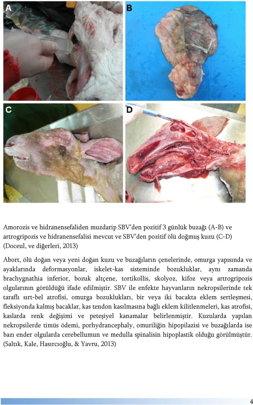 tortikollis, skolyoz, kifoz veya artrogripozis olgularının görüldüğü ifade edilmiştir.