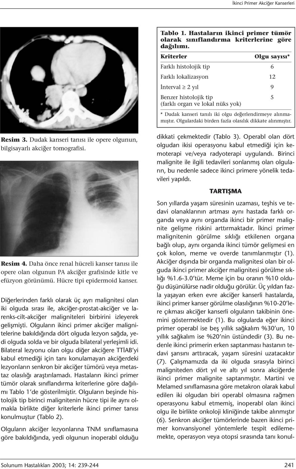 alınmamıştır. Olgulardaki birden fazla olasılık dikkate alınmıştır. Resim 3. Dudak kanseri tanısı ile opere olgunun, bilgisayarlı akciğer tomografisi. dikkati çekmektedir (Tablo 3).