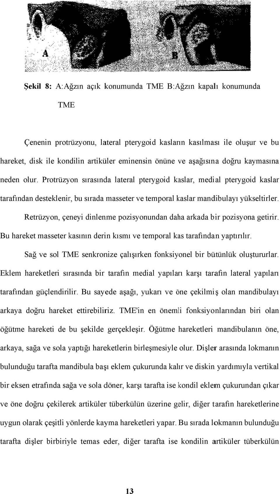 Retrüzyon, çeneyi dinlenme pozisyonundan daha arkada bir pozisyona getirir. Bu hareket masseter kasının derin kısmı ve temporal kas tarafındanan yaptırılır.