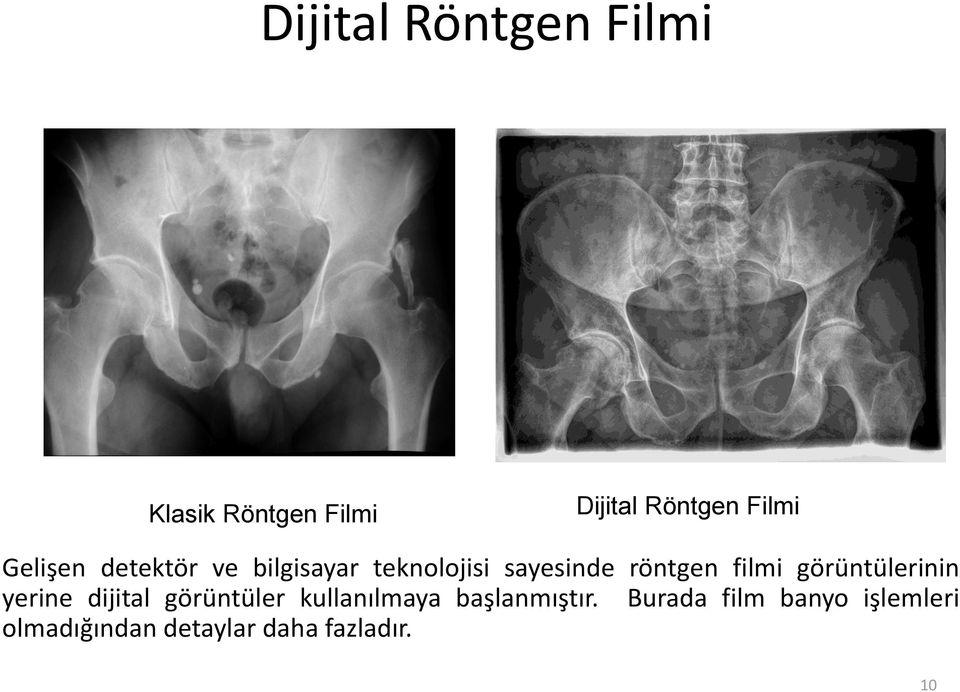 görüntülerinin yerine dijital görüntüler kullanılmaya başlanmıştır.