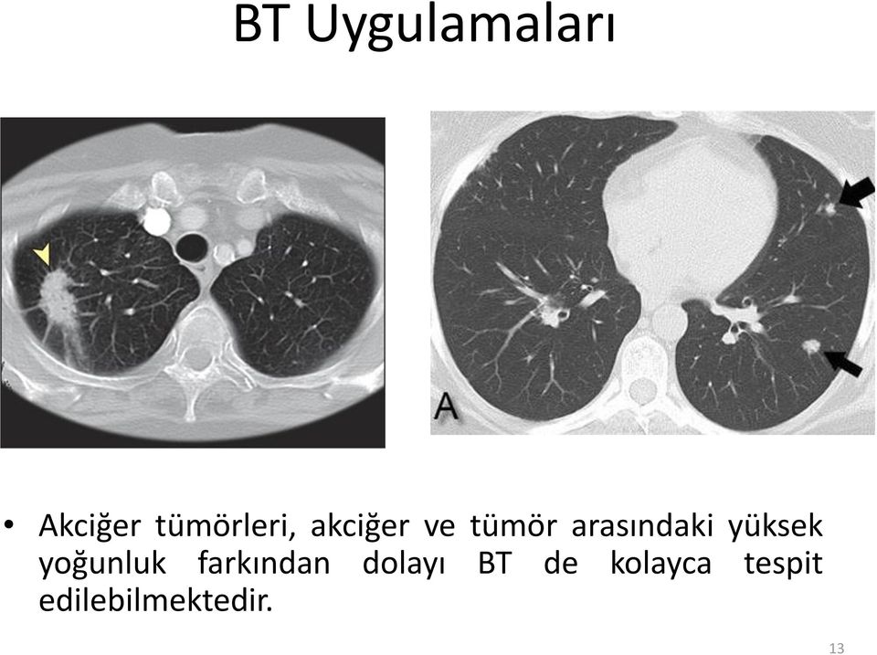 yoğunluk farkından dolayı BT de