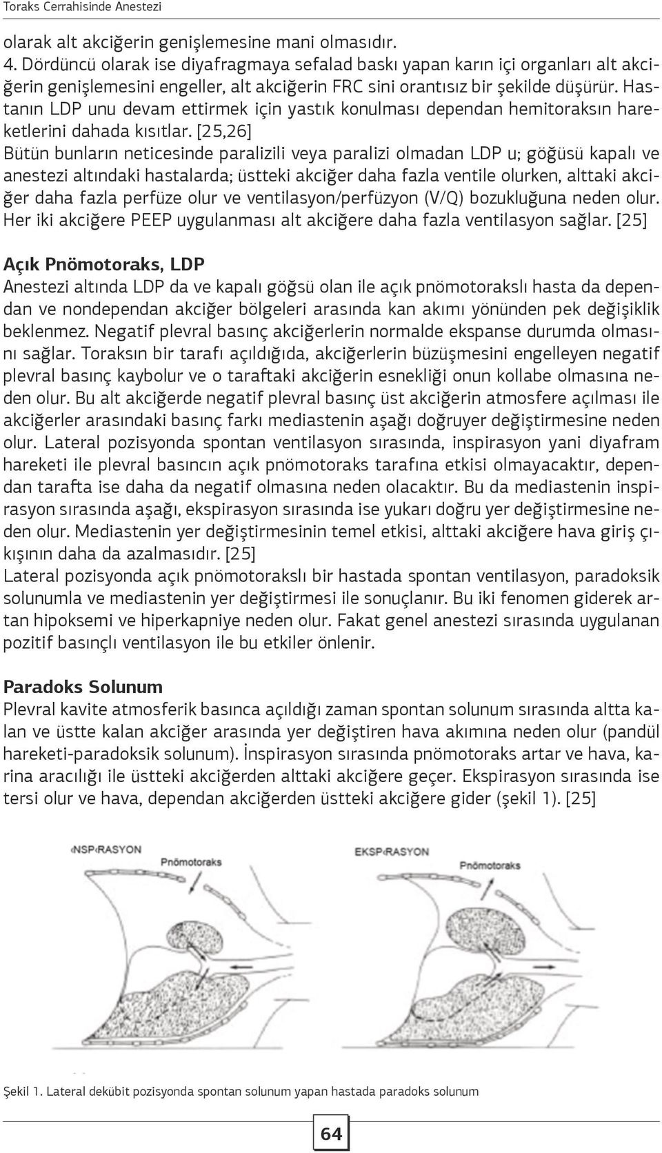 Hastanın LDP unu devam ettirmek için yastık konulması dependan hemitoraksın hareketlerini dahada kısıtlar.