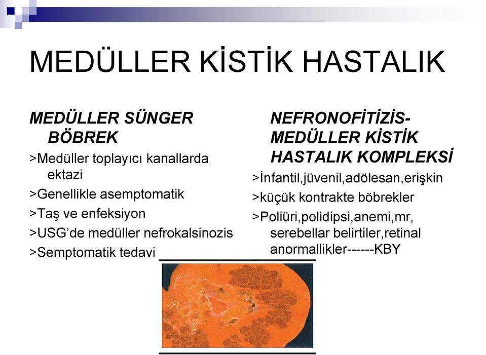 tedavi NEFRONOFİTİZİS- MEDÜLLER KİSTİK HASTALIK KOMPLEKSİ >İnfantil,jüvenil,adölesan,erişkin