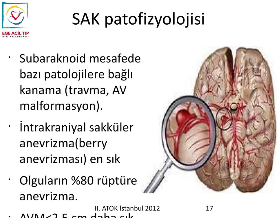 İntrakraniyal sakküler anevrizma(berry anevrizması)