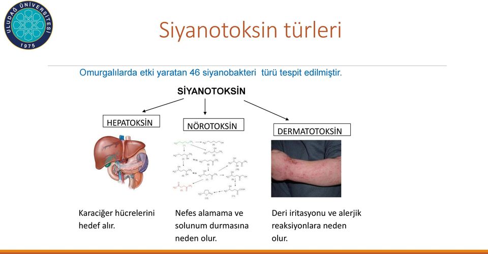 SİYANOTOKSİN HEPATOKSİN NÖROTOKSİN DERMATOTOKSİN Karaciğer