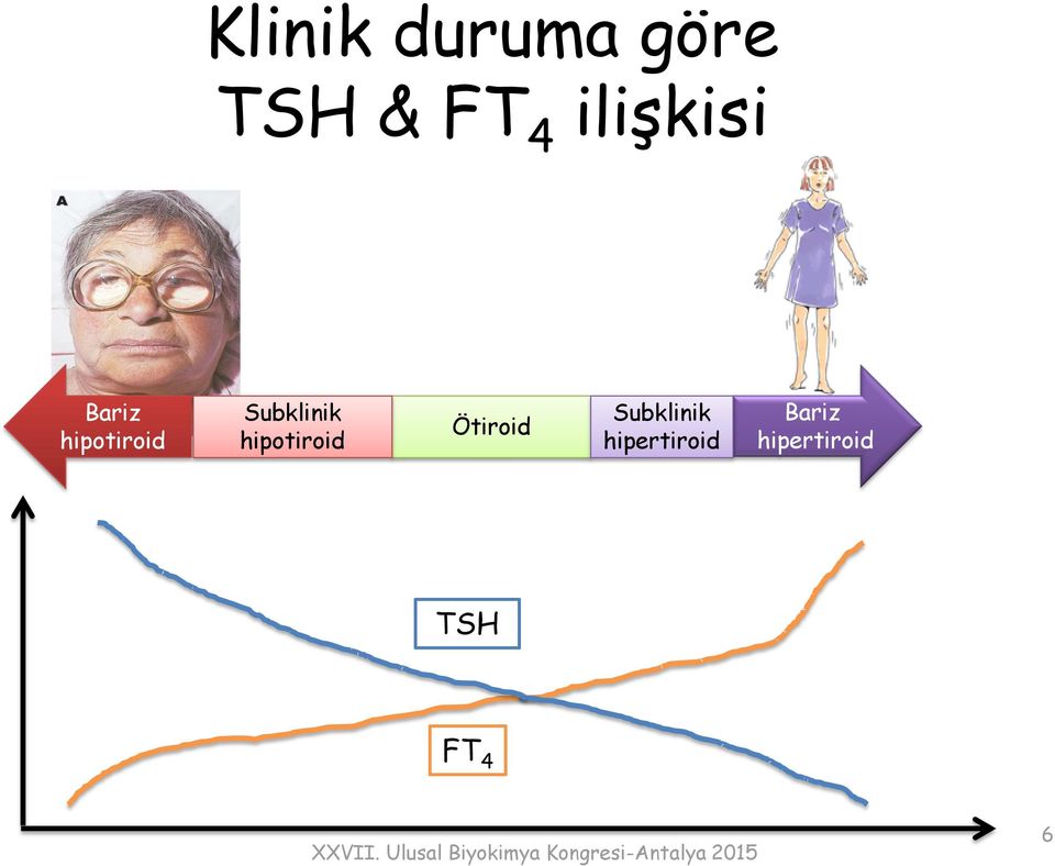 Subklinik hipotiroid Ötiroid