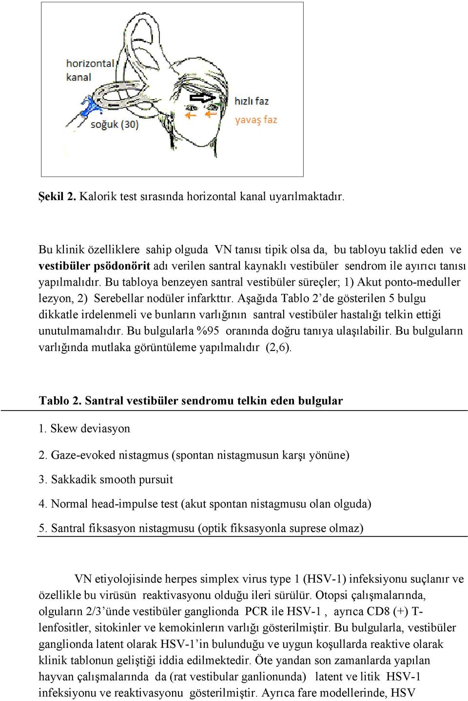 Bu tabloya benzeyen santral vestibüler süreçler; 1) Akut ponto-meduller lezyon, 2) Serebellar nodüler infarkttır.