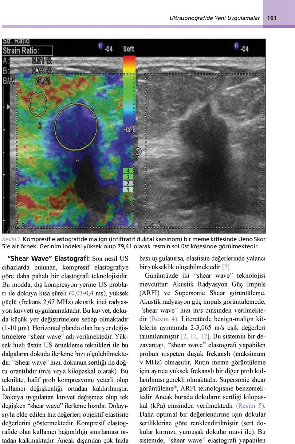 Shear Wave Elastografi: Son nesil US cihazlarda bulunan, kompresif elastografiye göre daha pahalı bir elastografi teknolojisidir.