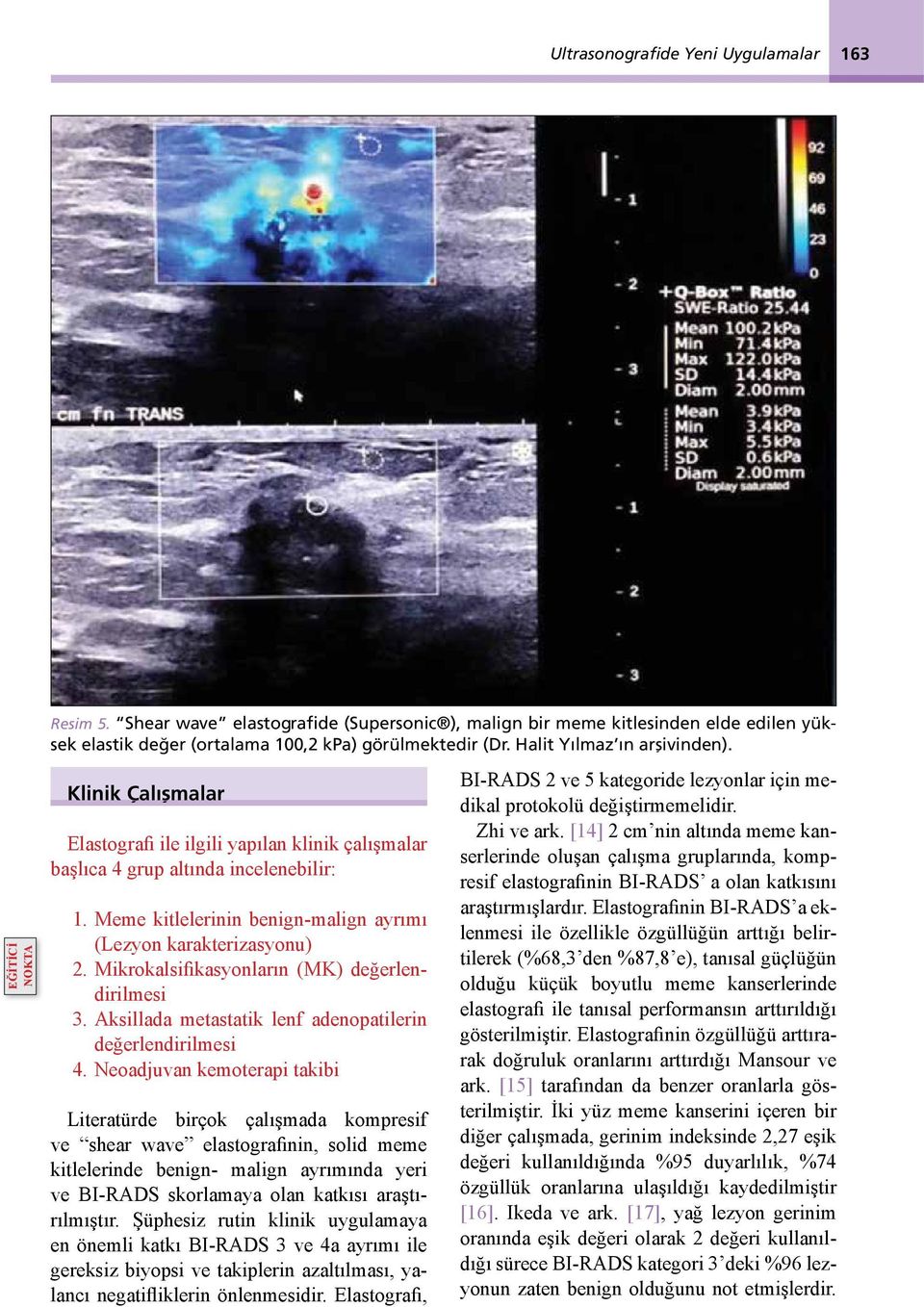 Klinik Çalışmalar Elastografi ile ilgili yapılan klinik çalışmalar başlıca 4 grup altında incelenebilir: 1. Meme kitlelerinin benign-malign ayrımı (Lezyon karakterizasyonu) 2.