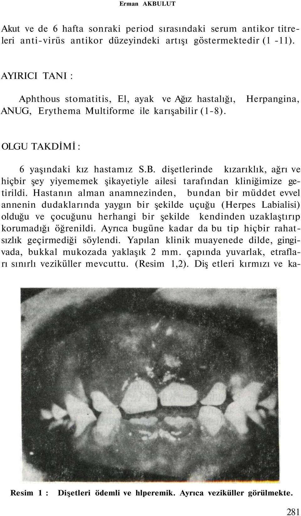 dişetlerinde kızarıklık, ağrı ve hiçbir şey yiyememek şikayetiyle ailesi tarafından kliniğimize getirildi.