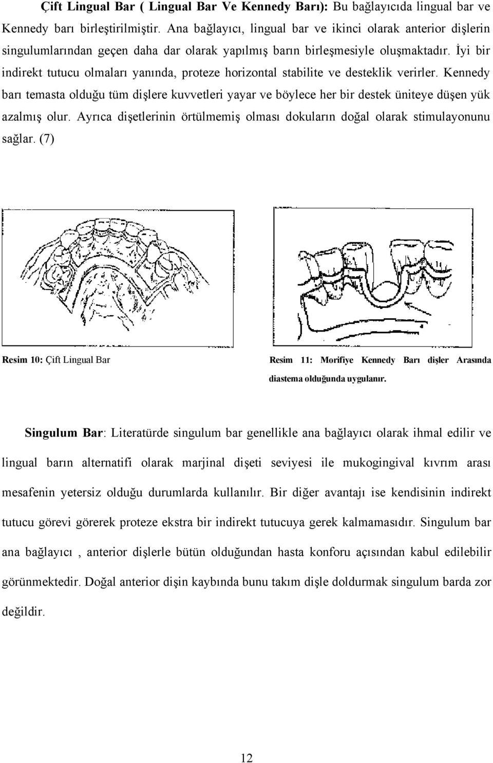 İyi bir indirekt tutucu olmaları yanında, proteze horizontal stabilite ve desteklik verirler.