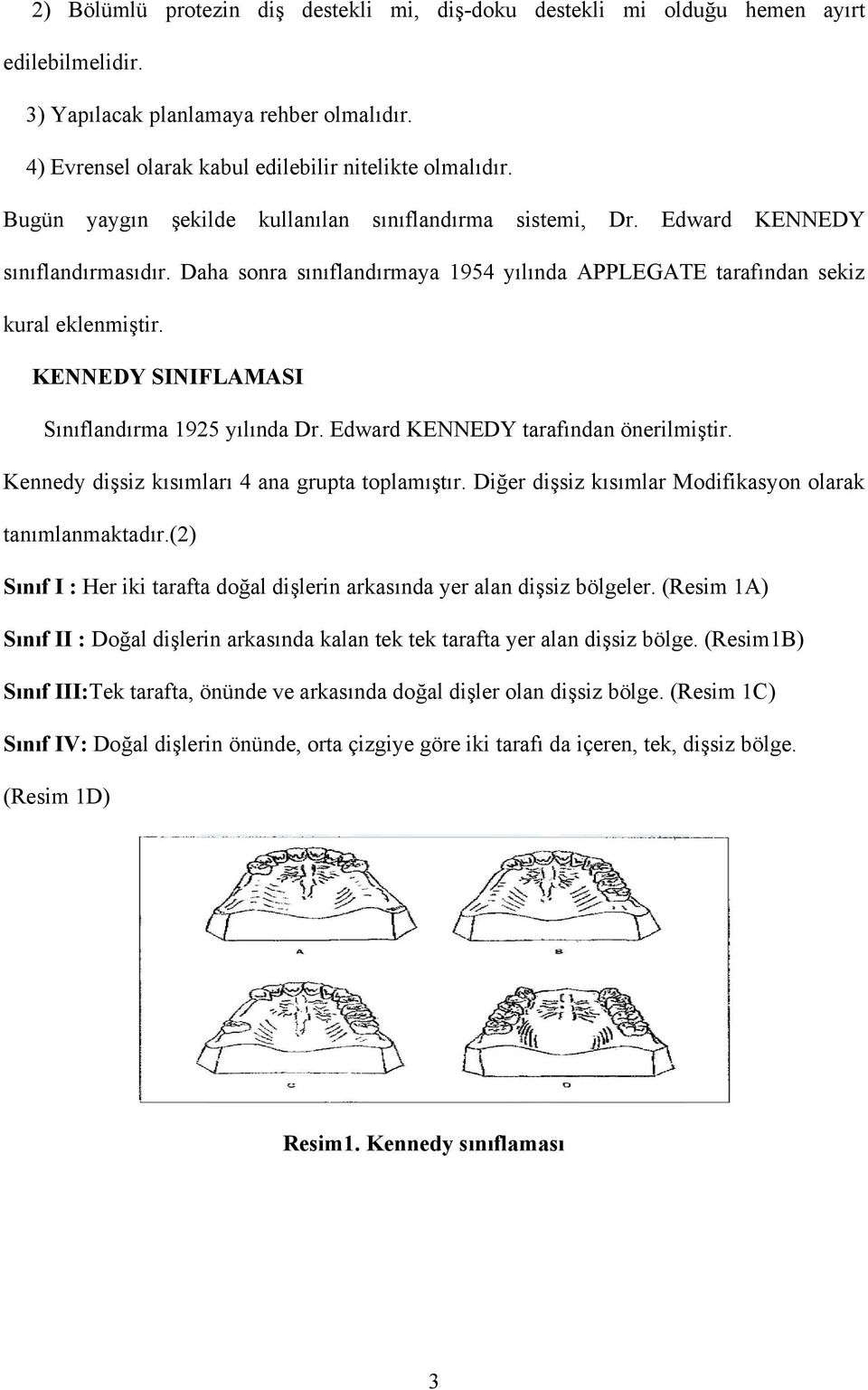 KENNEDY SINIFLAMASI Sınıflandırma 1925 yılında Dr. Edward KENNEDY tarafından önerilmiştir. Kennedy dişsiz kısımları 4 ana grupta toplamıştır.