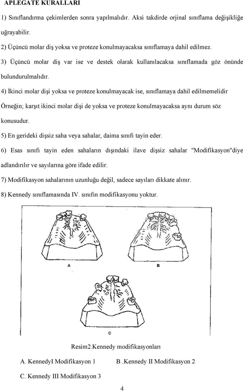 4) İkinci molar dişi yoksa ve proteze konulmayacak ise, sınıflamaya dahil edilmemelidir Örneğin; karşıt ikinci molar dişi de yoksa ve proteze konulmayacaksa aynı durum söz konusudur.