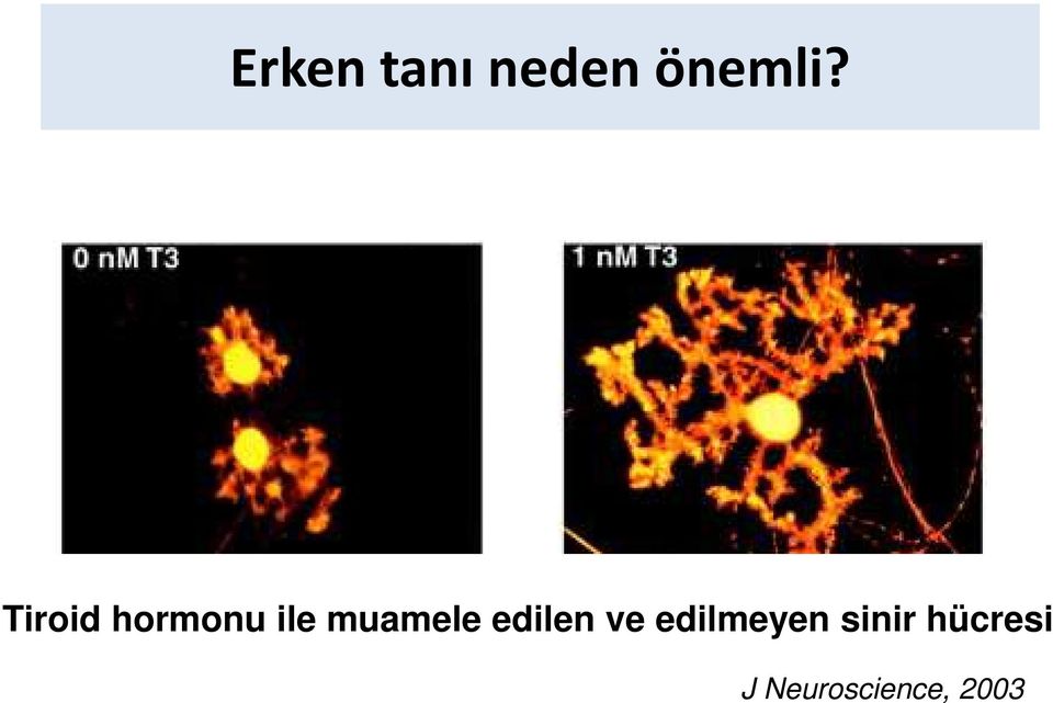 edilen ve edilmeyen sinir