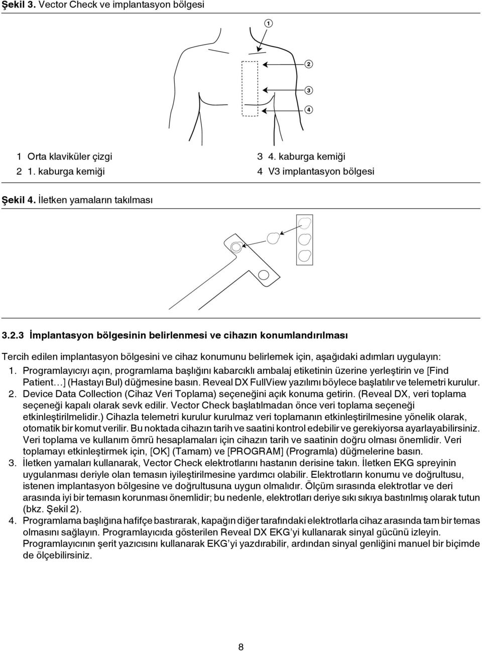 3 İmplantasyon bölgesinin belirlenmesi ve cihazın konumlandırılması Tercih edilen implantasyon bölgesini ve cihaz konumunu belirlemek için, aşağıdaki adımları uygulayın: 1.