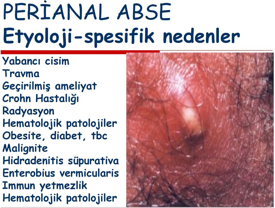 patolojiler Obesite, diabet, tbc Malignite Hidradenitis