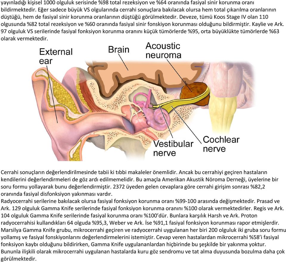 Deveze, tümü Koos Stage IV olan 110 olgusunda %82 total rezeksiyon ve %60 oranında fasiyal sinir fonskiyon korunması olduğunu bildirmiştir. Kaylie ve Ark.