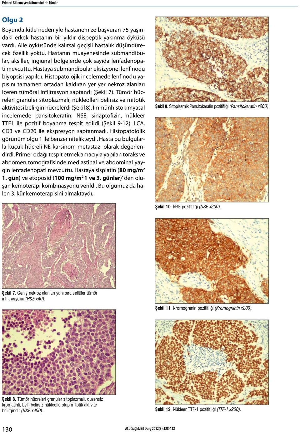 Hastaya submandibular eksizyonel lenf nodu biyopsisi yapıldı.